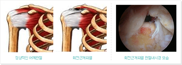 http://www.djtntn.com/ds4_1_1.html joint1_01_img1.gif